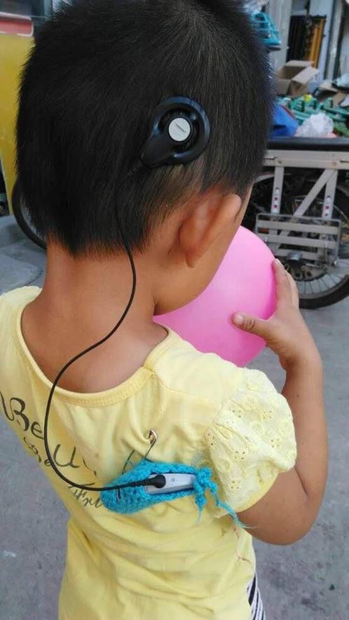听障女童遗失昂贵人工耳蜗