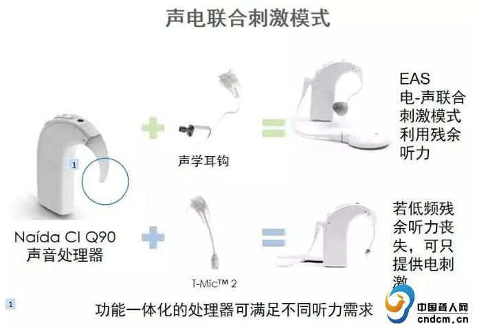 人工耳蜗知识|美国耳蜗的新技术和特色